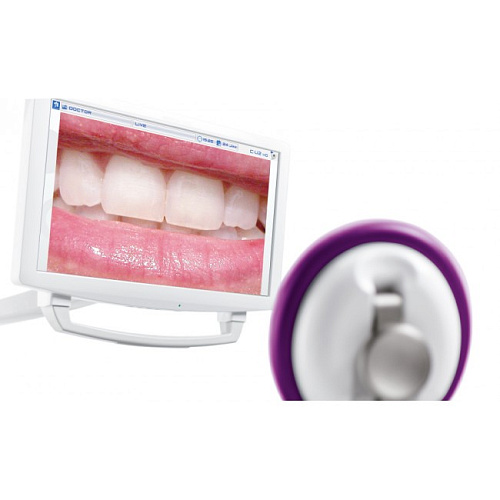 KaVo C-U2 - интраоральная камера высокого разрешения