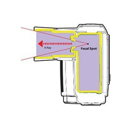 POSDION Rextar - портативный рентген