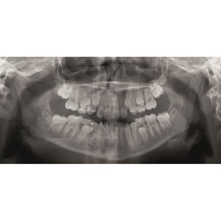 KaVo GENDEX GXDP-300 - цифровая панорамная рентгенодиагностическая система